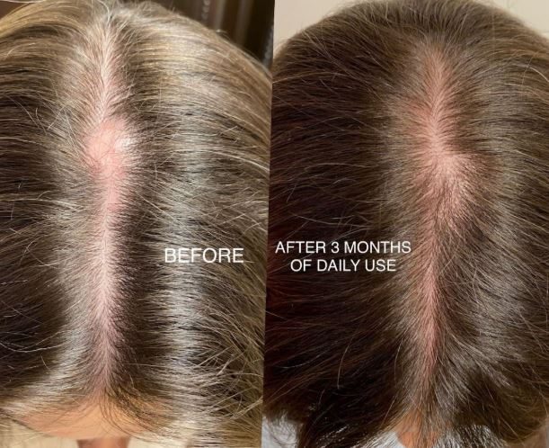 preventia impotriva caderii parului, rehair by ibrows